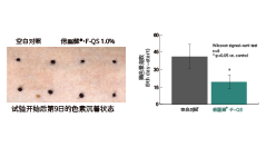 倍麗蘇®・F-QS(圖4)